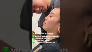 #YOOnose Nonsurgical Nose Job (Liquid Rhinoplasty) by Dr. Donald B. Yoo 👨🏻&zwj;⚕️  #nosejob #asian