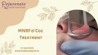 Best Aesthetic clinic in Delhi
