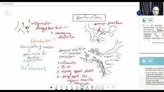 ek   clinical assessment of bronchiectasis
