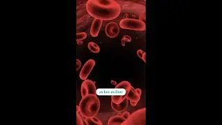 Uterine Fibroids And Anemia: Why Gradual Blood Loss Can Be Dangerous Without You Even Noticing
