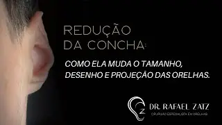 Redução da concha + reestruturação completa da orelha conheça os detalhes. #macrotia 