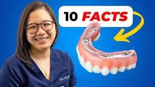 10 Facts About All On 4 Dental Implants You Need To Know