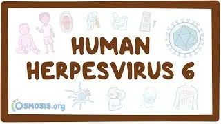 Human herpesvirus 6 (Roseola) - an Osmosis Preview