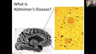 Webinar: Re-Imagining Our Approach to Brain Health - Hosted by Ida Culver House Ravenna