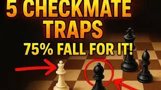 Five checkmage traps that 75% fall for it #chessedit #chess 