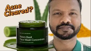 This Organic Neem Basil Face Wash Cleared My Skin | Rustic Art Honest Review | Best face wash