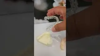 Wie sieht eine Zahnschiene aus? CMD, Schiene gegen Knirschen