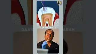 Candid Smiles Dental &ndash; RCT, Care & Confidence Expert Care for Your Perfect Smile #candidsmiles