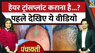Hair Transplant में कितना खर्च कितना साइड इफेक्ट? Panchayati में Dr. Gaurang Krishna ने बताया सच