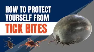 Tick Bite Prevention