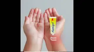 Flamigel&reg; &pi;ά&nu;&tau;&alpha; &sigma;&tau;&omicron; &sigma;&pi;ί&tau;&iota;!