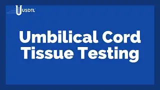 Umbilical Cord Tissue Drug Testing