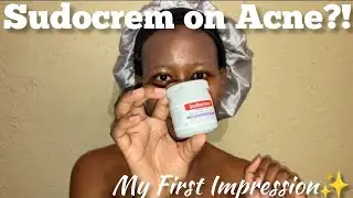 Trying Sudocrem for Acne & Skin Barrier Repair (First Impressions)