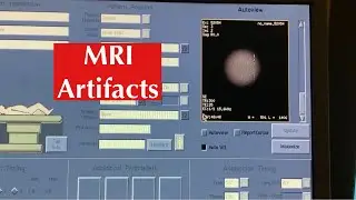 Effects of Metal in MRI