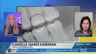 We Are Not Alone: Mysterious implant put in tooth, woman says