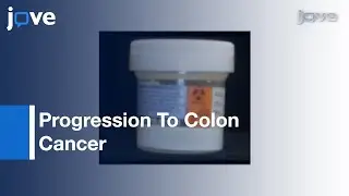 Deficient Pms2/ERCC1/Ku86/CcOI: Field Defects During Progression To Colon Cancer l Protocol Preview