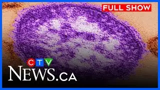 Canada loses its measles elimination status | CTV News Edmonton at Five for Nov. 10, 2025