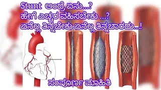 Angioplasty / stent ಬಗ್ಗೆ ಸಂಪೂರ್ಣ ಮಾಹಿತಿ..! stent ಯಾಕೆ ಹಾಕುತ್ತಾರೆ&hellip;!? post care of angioplasty &hellip;! 🫀🫵🏻