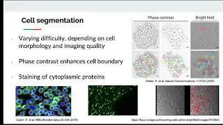 3000788 Fall 2025 L22 - Image processing for microscopy data