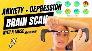 Brain Scan Review: 34yr old with a history of OCD, anxiety, and depression.