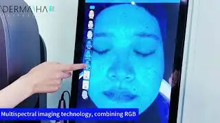 #skinanalyzer #faceanalyzer#spa