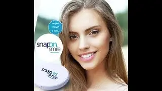 Виниры Snap-On Smile