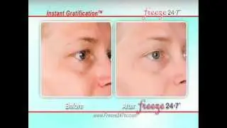 Freeze 24/7 giovane in pochi minuti