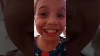 Outro dente se foi #shortvideo #dente #youtube