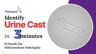 Urine Casts Explained in 3 Minutes | Practical Pathology for Doctors & Lab Techs | Pathopedia 
