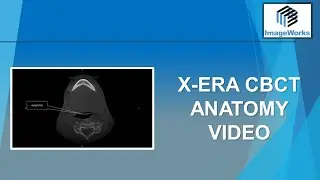 X-era CBCT Anatomy Video