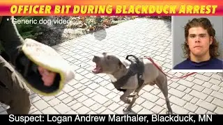 Officer Bit During Blackduck Arrest