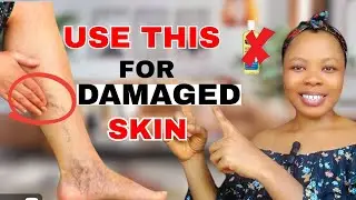BODY LOTIONS For Green veins,Red Veins & Thin Skin. Skin repair body lotion