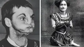 15 Circus Freaks You&rsquo;ve Probably Never Heard Of