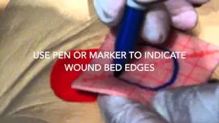 PolyMem Dressing Change