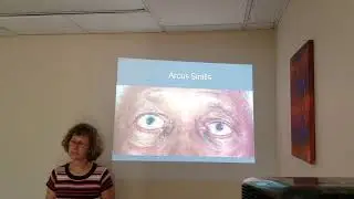 Vision Loss in the Elderly