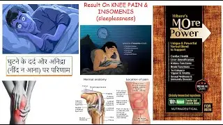 Result in body pain, sleep disorder & knee pain by Ms. Mumtaz Mam