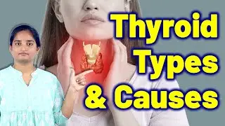 Каковы типы и причины проблем со щитовидной железой и шейными лимфатическими узлами? | Гомеопатия...