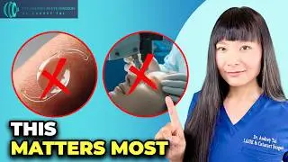 The #1 Cataract Surgery Decision That Matters More Than the Lens or Laser | Eye Surgeon Explains