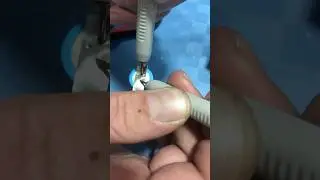 Punktovanje celija 18650 #viral #viralshorts #battery #repair