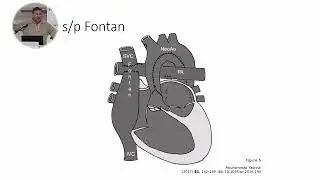9. Cardiology research presentation by Dr. Paul Grossfeld (EN)