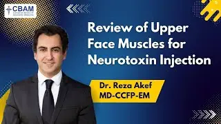 Mastering Upper Face Anatomy 💉✨ Essential Guide for Neurotoxin Injections!