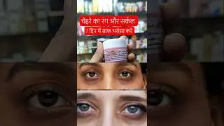Irani face cream#iranicream#darkcircles#brightskin#shortsfeed#rizvicosmetic#shorts#nightcream#beauty