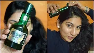 *Honest Review* केश किंग हेयर आयिल मेरा अनुभव  | KESH KING Hair Oil Review in Hindi (2017)