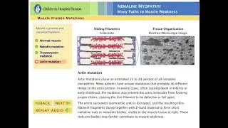Understanding Nemaline Myopathy: An Animation