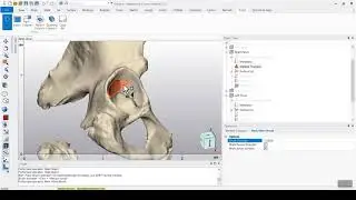 Automatic Acetabular Cup Placement Script