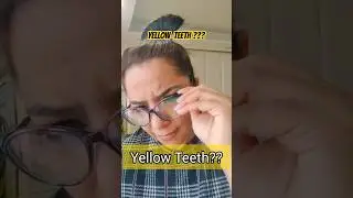 Dental cleaning is recommended every 6 months #dental #hacks #beautyhacks #beautifulgirl #trending