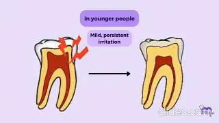 Disease of pulp #chettinaddentalcollege 