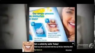 Watch Imako Cosmetic Teeth&reg; Fitting Instructions - Cosmetic Teeth