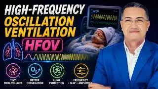 HFOV in the NICU: When and How to Use It for Better Oxygenation