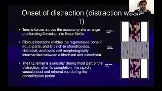 Biology of Distraction Histogenesis - Dr Vikram Khanna